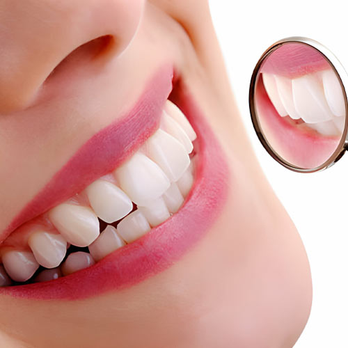 Dental surgery in Vijayawada