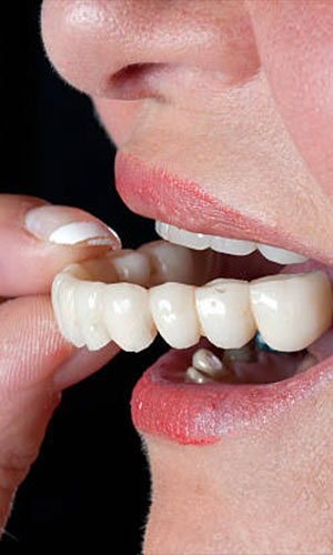 Dentures Treatment in Vijayawada