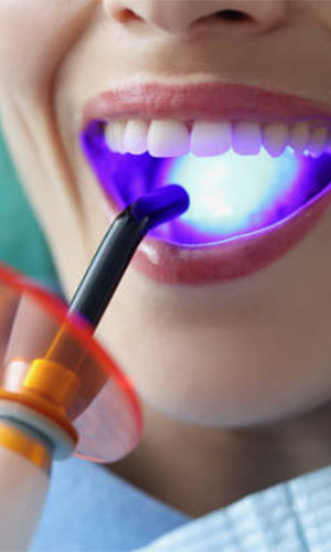 Laser dentistry in Vijayawada