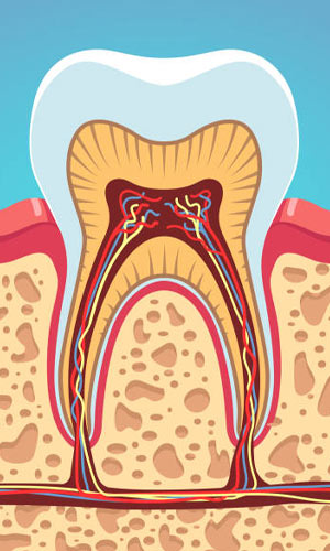 root canal treatment